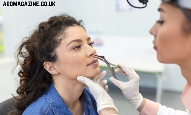 Nostril Reduction Surgery