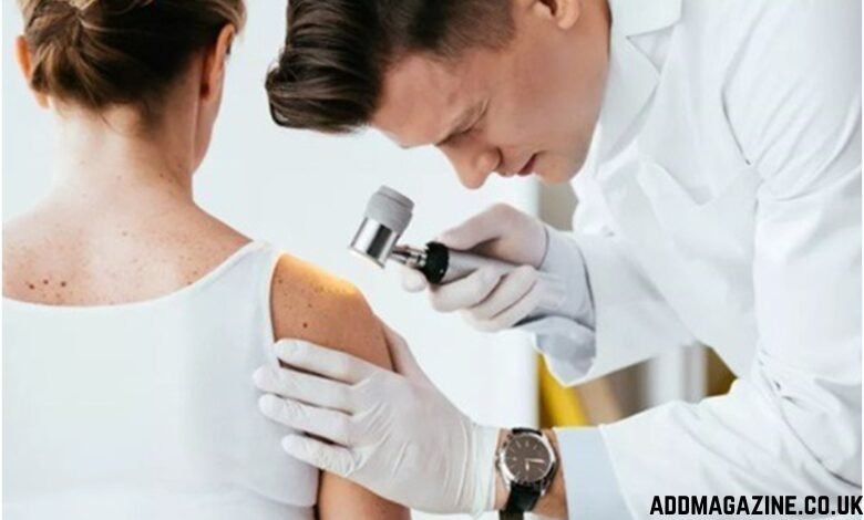 skin clinic Barnet
