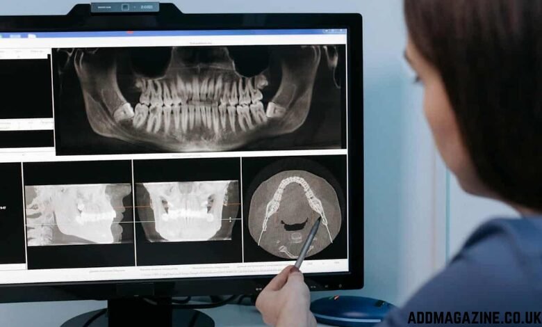 Implant Dentist in Sacramento