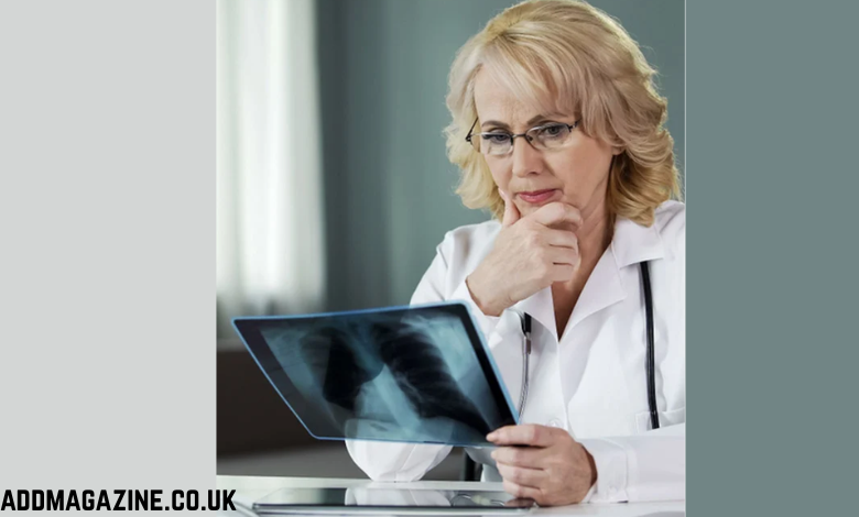 How To Use a Pulmonologist Mailing Database for B2B Lead Generation