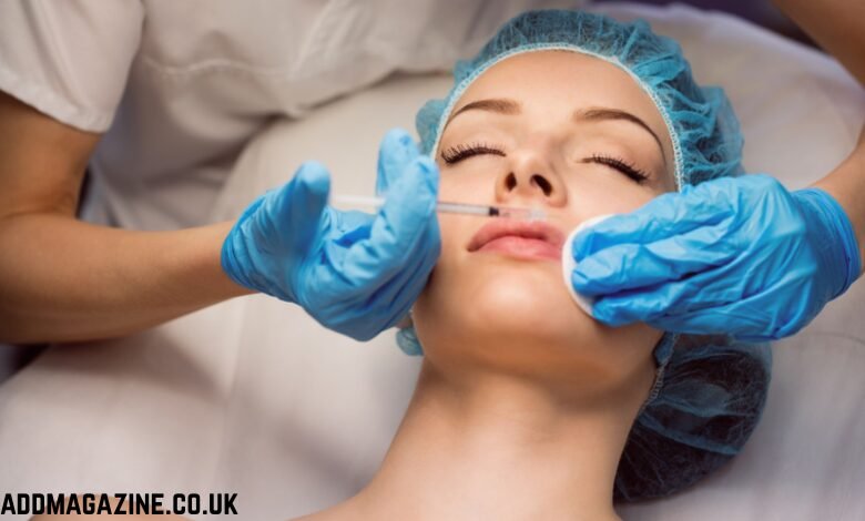 Address Smile Lines with Nasolabial Filler: What You Need to Know