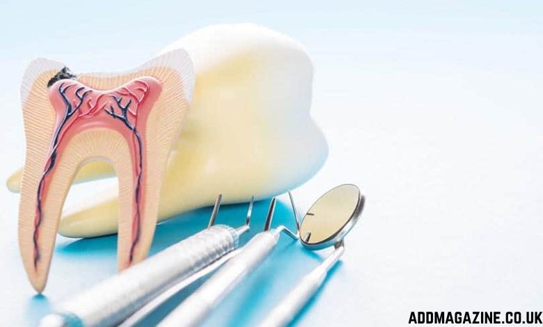 Affordable care dental services root canal therapy