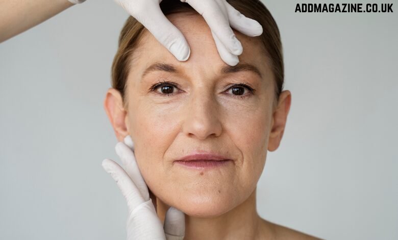 facelift surgery London