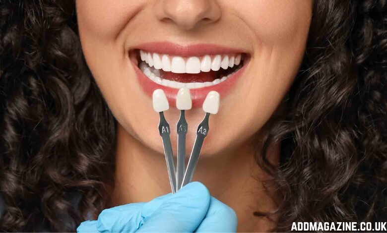 Invisalign in Lakewood Ranch