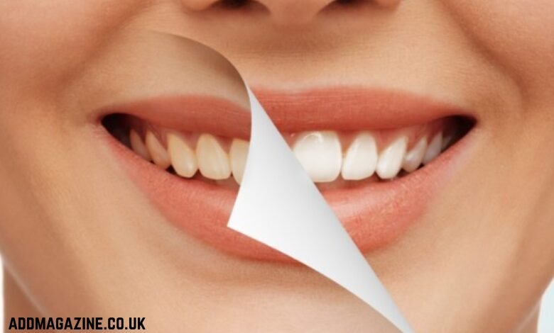 Walnut Creek dentist