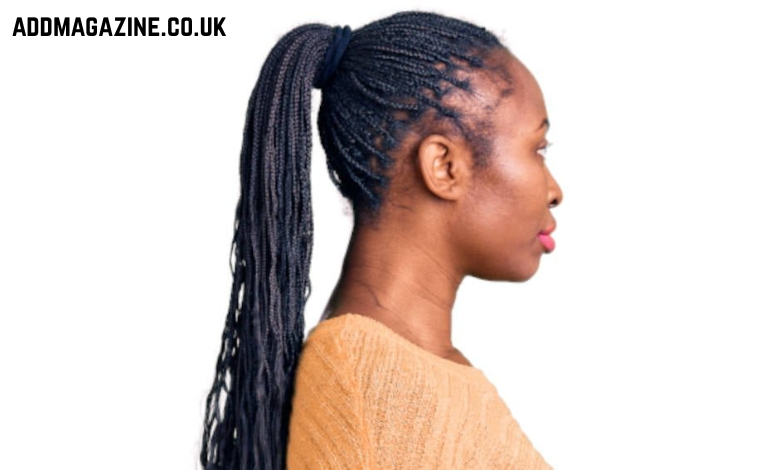 Traction Alopecia Hair Transplant: Causes, Treatment & Results