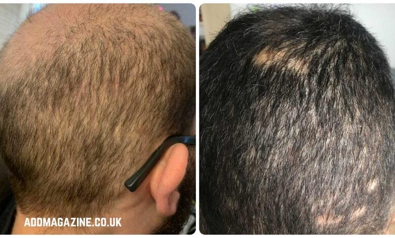 Dr. Ross from Kopelman Hair