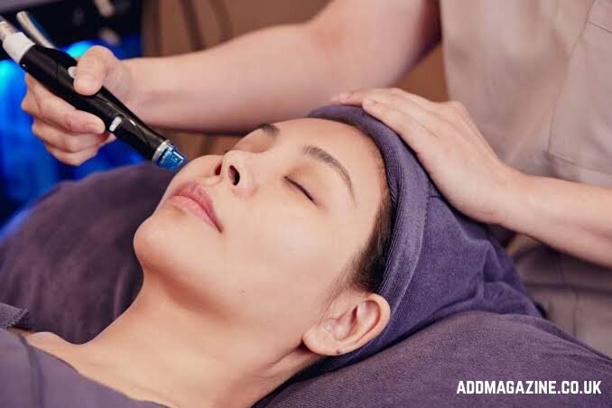 acne treatment