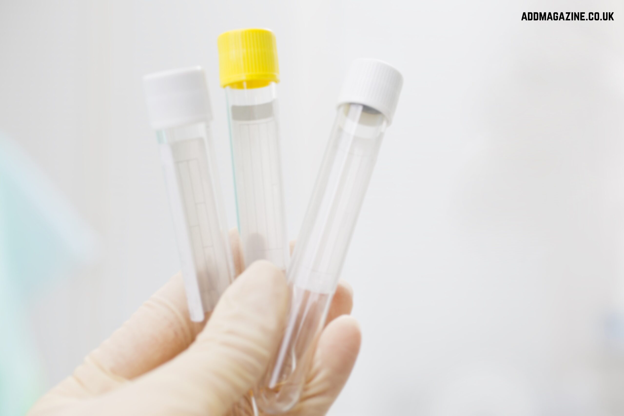  screw-cap tubes 