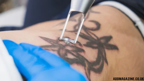 leading tattoo removal clinic in Decatur